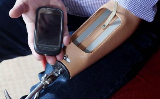 SF! Primul om care traieste cu un telefon mobil montat in mana  Sf Primul Om Care Traieste Cu Un Telefon Mobil Montat In Brat