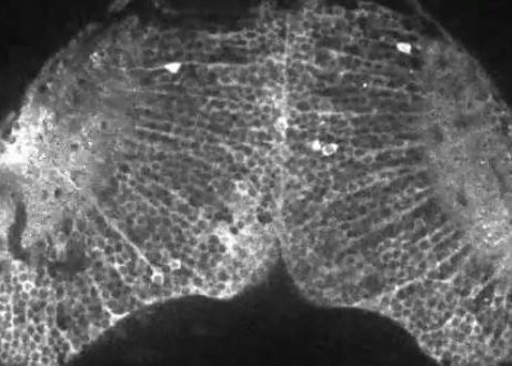 Cum se formeaza gandurile intr-un creier. Experiment filmat in premiera. VIDEO Cum Se Formeaza Gandurile Intr Un Creier Experiment Filmat In Premiera Video