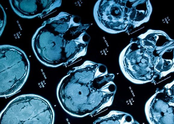 Cercetatorii au reusit sa citeasca gandurile unui soarece Cercetatorii Au Reusit Sa Citeasca Gandurile Unui Soarece