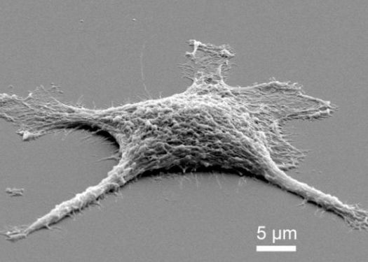 Cercetatorii au creat celule zombie , care traiesc si dupa ce mor Cercetatorii Au Creat Celule Zombie Care Traiesc Si Dupa Ce Mor