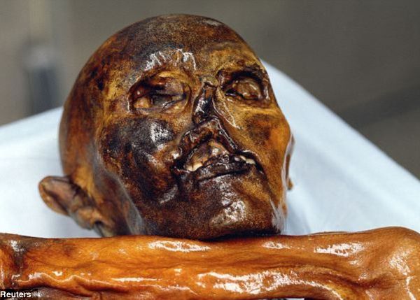 Otzi, omul cu varsta de 5.300 de ani gasit in Alpi a fost dus la dentist Otzi Omul Cu Varsta De 5 300 De Ani Gasit In Alpi A Fost Dus La Dentist