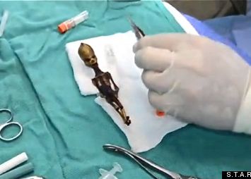 Misterul extraterestrului descoperit in Chile. Ce au aflat cand au studiat radiografia. FOTO si VIDEO Misterul Extraterestrului Descoperit In Chile Ce Au Aflat Cand Au Studiat Radiografia Foto Si Video