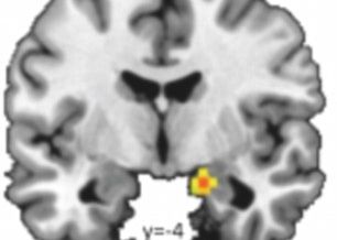 Noi scanari ale creierului dau raspunsul la intrebarea: De ce barbatii nu inteleg femeile? Noi Scanari Ale Creierului Dau Raspunsul La Intrebarea De Ce Barbatii Nu Inteleg Femeile