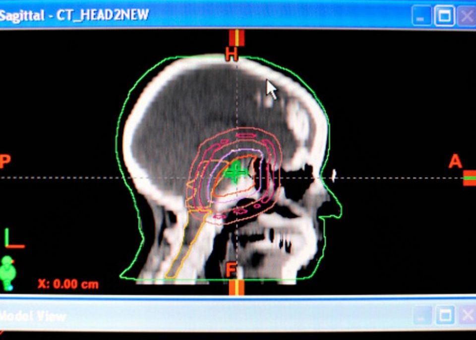 Computerul care poate depista cancerul mai repede decat doctorul Computerul Care Poate Depista Cancerul Mai Repede Decat Doctorul 2