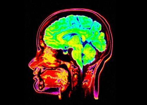 Cauti ceva? Creierul are capabilitatea de a-si mobiliza mai multe parti ca sa te ajute Cauti Ceva Creierul Are Capabilitatea De A Si Mobiliza Mai Multe Parti Ca Sa Te Ajute