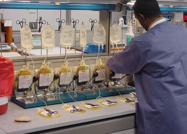 Pancreasul artificial, promisiunea care va transforma tratamentul diabeticilor Pancreasul Artificial Promisiunea Care Va Transforma Tratamentul Diabeticilor