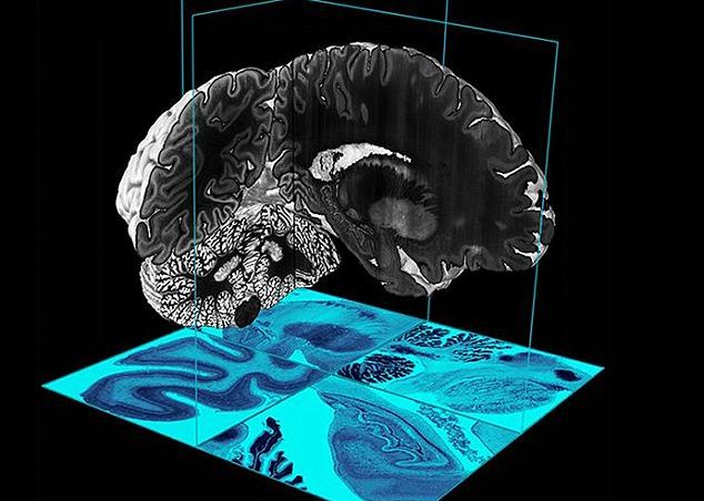 Oamenii de stiinta au creat prima harta 3D a creierului uman Oamenii De Stiinta Au Creat Prima Harta 3d A Creierului Uman