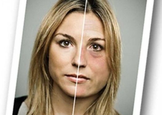 Ce Detaliu A Putut Schimba In Acest Fel Chipul Tinerei Din Fotografie Diferenta Este Surprinzatoare