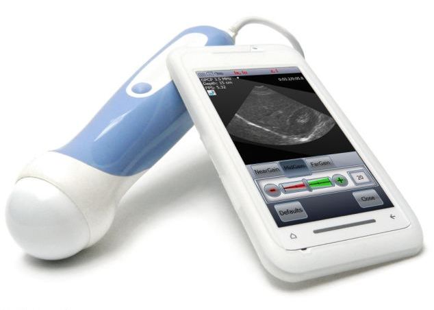 Smartphone-ul poate deveni un scanner cu ultrasunete, fapt ce ar revolutiona medicina Smartphone Ul Poate Deveni Un Scanner Cu Ultrasunete Fapt Ce Ar Revolutiona Medicina
