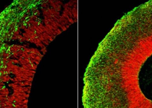 Oamenii De Stiinta Au Crescut Un Mic Creier In Laborator