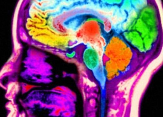 Studiu Persoanele Care Au Insomnii Isi Pierd Concentrarea Mult Mai Repede