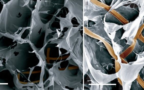 Jumatate om, jumatate masina. Cercetatorii de la Harvard au creat primul tesut biologic cu tranzistori si fire Jumatate Om Jumatate Masina Cercetatorii De La Harvard Au Creat Primul Tesut Biologic Cu Tranzistori Si