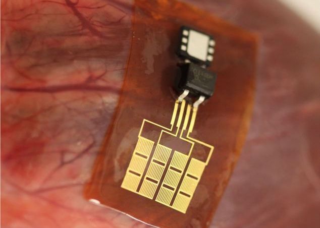 Cipul care permite incarcarea telefonului mobil cu energia inimii Chipul Care Permite Incarcarea Telefonului Mobil Cu Energia Inimii