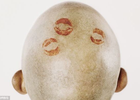 Oamenii De Stiinta Au Descoperit Leacul Pentru Chelie