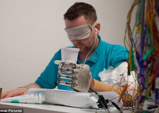 Primul pacient care si-a recapatat simtul atingerii dupa un implant de mana bionica Primul Pacient Care Si A Recapatat Simtul Atingerii Dupa Un Implant De Mana Bionica