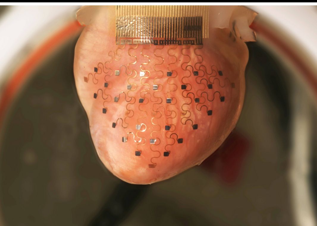 Inima Poate Fi Ajutata De O Imprimata 3d