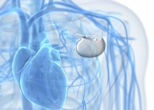 Descoperire Importanta In Industria Farmaceutica Pastilele Pot Fi Inlocuite In Curand Cu Implanturi Wireless