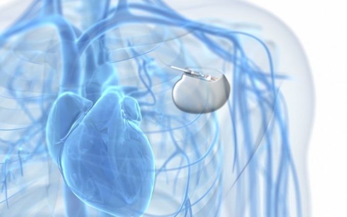 Descoperire Importanta In Industria Farmaceutica Pastilele Pot Fi Inlocuite In Curand Cu Implanturi Wireless