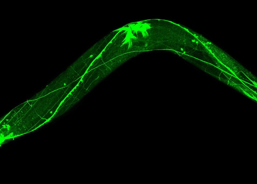Creatura Care Ascunde Secretul Nemuririi Se Poate Opri Din Dezvoltare Oricand
