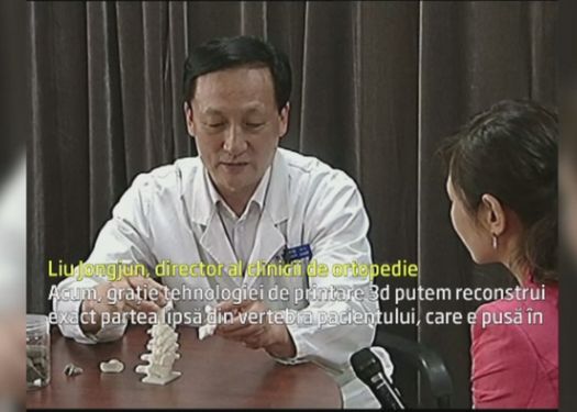 Tehnologia Printarii 3d Tot Mai Prezenta In Medicina Premiera Pe Care Au Realizat O Doctorii Din China