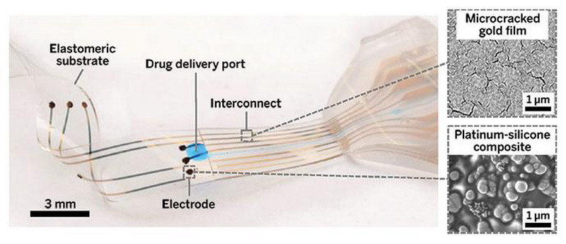 Un implant neuronal ar putea permite oamenilor paralizati sa mearga din nou