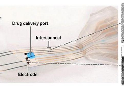 Un Implant Neuronal Ar Putea Permite Oamenilor Paralizati Sa Mearga Din Nou