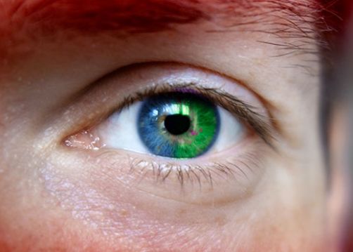 Secretul Omului Cu Un Ochi Pe Jumatate Verde Cazul Care A Uimit O Lume Intreaga