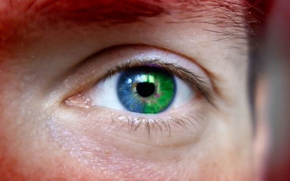 Secretul Omului Cu Un Ochi Pe Jumatate Verde Cazul Care A Uimit O Lume Intreaga