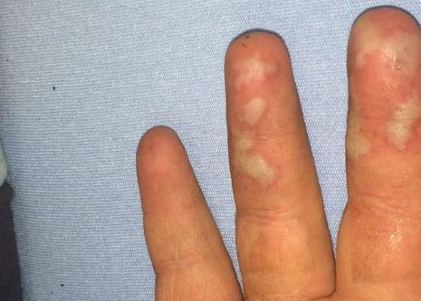 I A Luat Foc Casa Din Cauza Unui Iphone Ce S A Intamplat In Timp Ce Telefonul Era La Incarcat