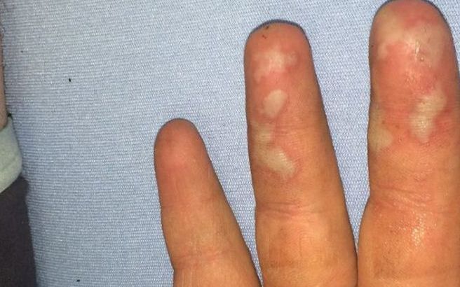 I A Luat Foc Casa Din Cauza Unui Iphone Ce S A Intamplat In Timp Ce Telefonul Era La Incarcat