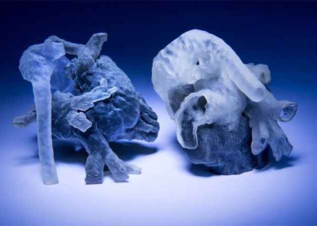 Moment Istoric In Medicina Realitatea Augmentata A Fost Folosita Pentru Prima Data In Timpul Unei Operatii