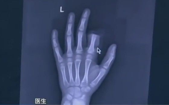 Decizia socanta luata de un copil de 11 ani! Ce a facut cand si-a dat seama ca e dependent de telefon Decizia Socanta Luata De Un Copil De 11 Ani Ce A Facut Cand Si A Dat Seama Ca E Dependent De Telefon