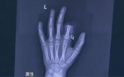 Decizia socanta luata de un copil de 11 ani! Ce a facut cand si-a dat seama ca e dependent de telefon