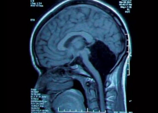 Detaliul Socant Descoperit De Medici La O Radiografie De Rutina Pacienta Aceasta Nu Ar Trebui Sa Traiasca