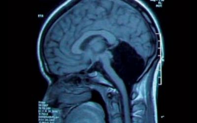 Detaliul socant descoperit de medici la o radiografie de rutina! Pacienta aceasta nu ar trebui sa traiasca