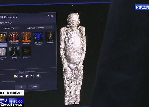 Credeau Ca Este Mumia Unei Cantarete Egiptene Ce Au Aflat Cand Au Scanat Trupul La Tomograf