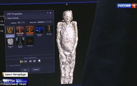 Credeau Ca Este Mumia Unei Cantarete Egiptene Ce Au Aflat Cand Au Scanat Trupul La Tomograf