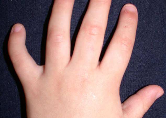 Ce Inseamna Daca Ai Degetul Aratator Mai Scurt Ca Inelarul Cercetatorii Au Descoperit Un Detaliu Surprinzator