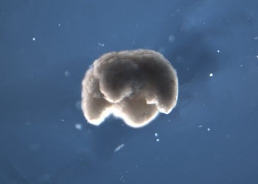 Cercetatorii Au Folosit Celule Stem Provenite De La Broaste Pentru A Construi Primii Zroboti Vii