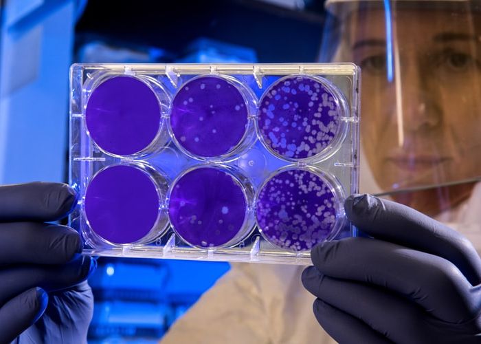 Cum Poate Zinfecta Coronavirusul Un Software De Calculator Sau Smartphone