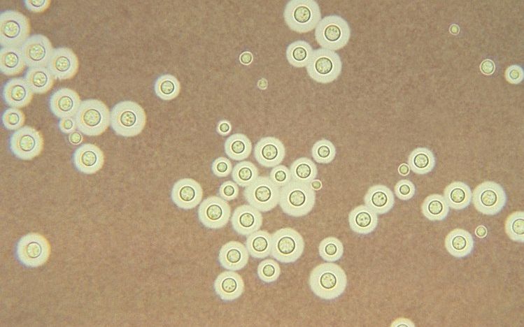 Descoperirea Incredibila Facuta De Cercetatori Pe Peretii Reactorului Nuclear 4 De La Cernobil