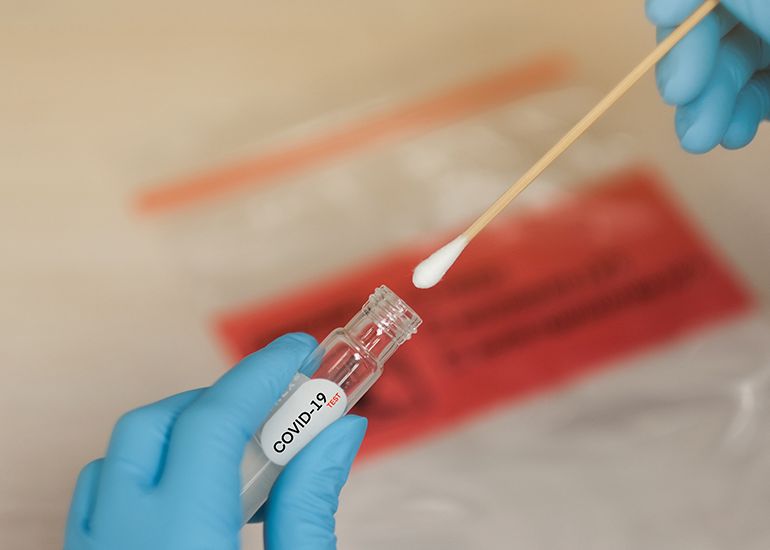 Cel Mai Rapid Test Covid 19 Iti Spune In Timp Record Daca Esti Sau Nu Infectat