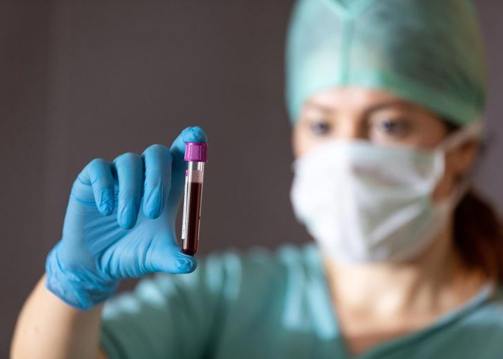 Oamenii Cu Aceste Grupe De Sange Sunt Mai Predispusi La Infectarea Cu Sars Cov 2