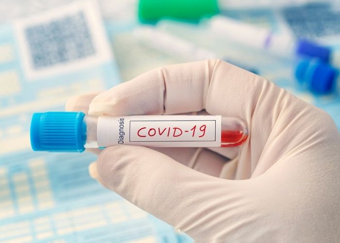 Planul prin care epidemia de Covid-19 ar putea fi eradicată în doar câteva săptămâni Planul Prin Care Epidemia De Covid 19 Ar Putea Fi Eradicata In Doar Cateva Saptamani