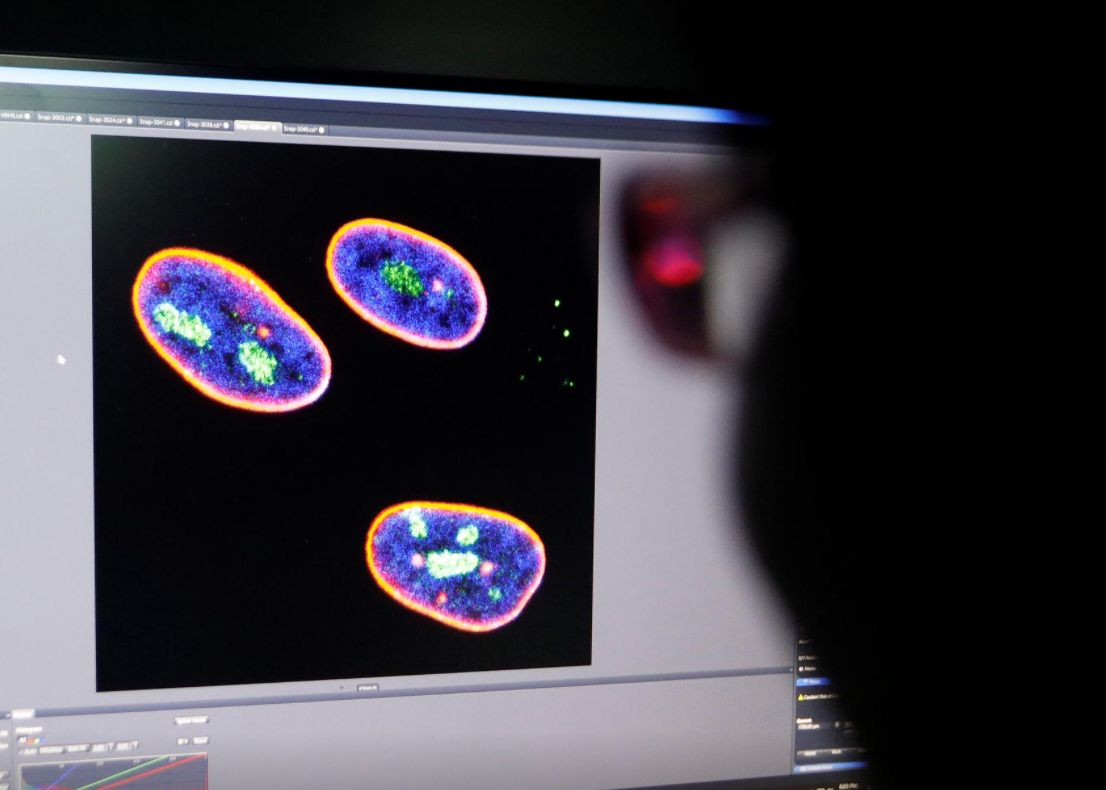 Terapia Pentru Inversarea Procesului Imbatranirii Dezvoltata De Cercetatorii Chinezi Cum Functioneaza