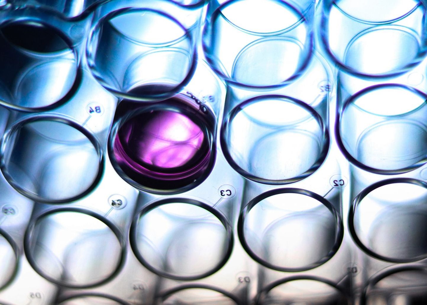 Inovatie In Medicina Doctorii Israelieni Ar Fi Gasit Punctul Vulnerabil Al Celulelor Canceroase