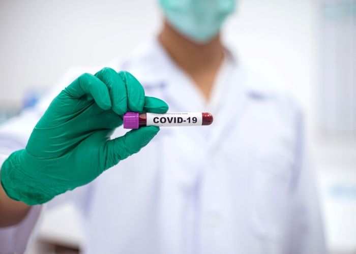 Anumite Persoane Sunt Mai Expuse Infectarii Cu Sars Cov 2 Te Afli Printre Ele