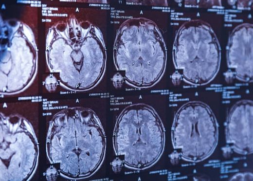 De Ce Este Creierul Uman Atat De Mare Cercetatorii Au Gasit Raspunsul