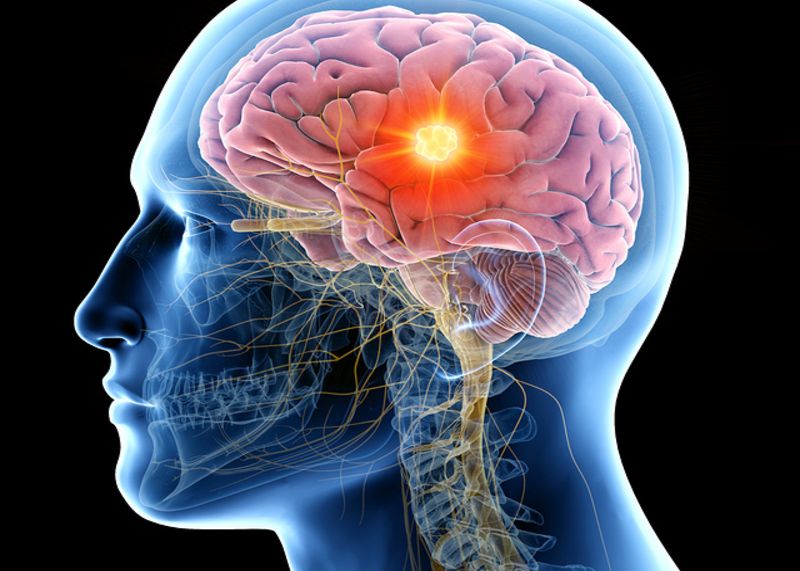 Boala Misterioasa Care A Afectat Deja Zeci De Oameni Si Despre Care Nimeni Nu Stie Nimic Znu Am Vazut