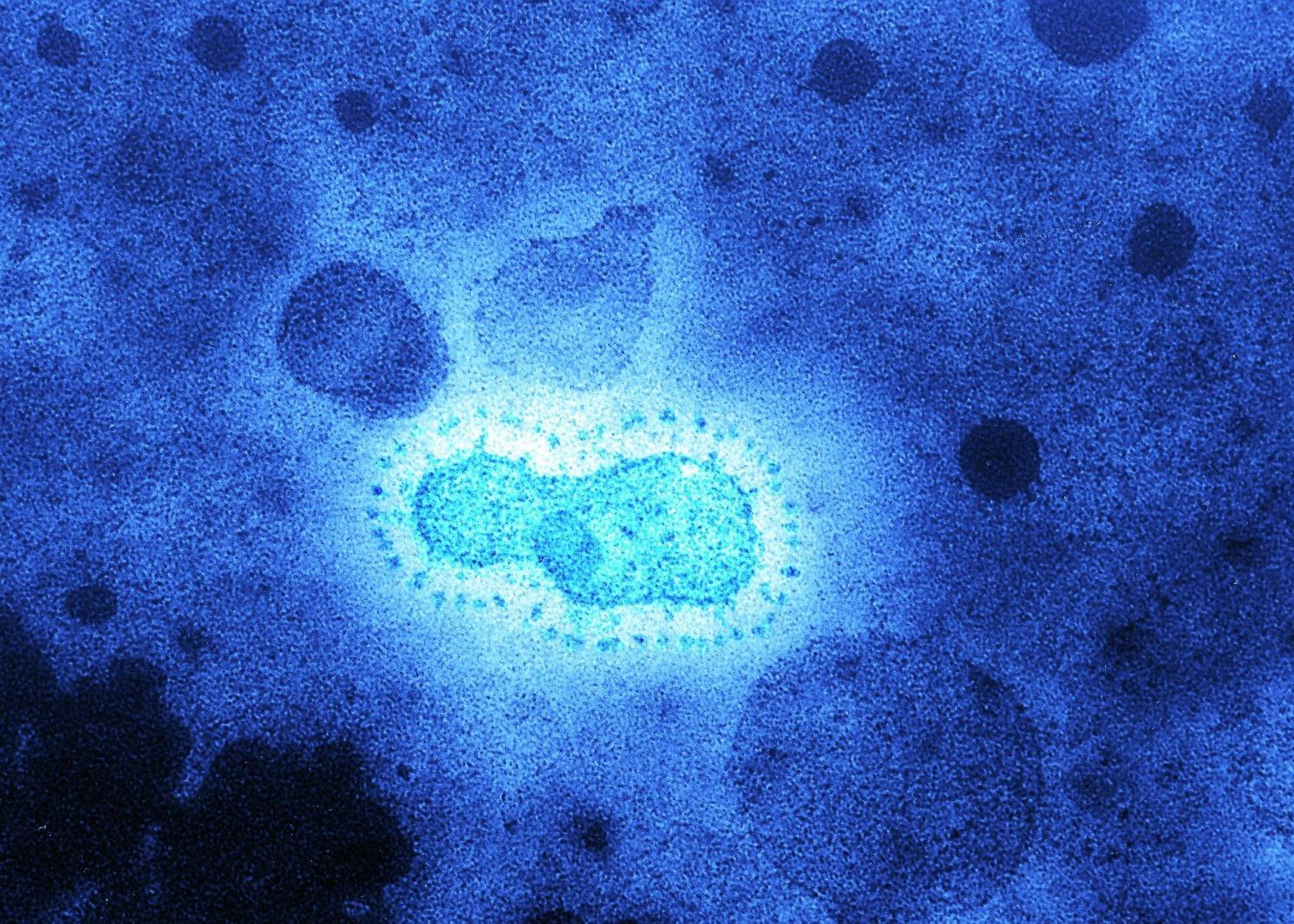 O Epidemie De Coronavirus Ar Fi Avut Loc In Urma Cu 20 000 De Ani Ar Putea Fi Solutia Pentru Epidemia
